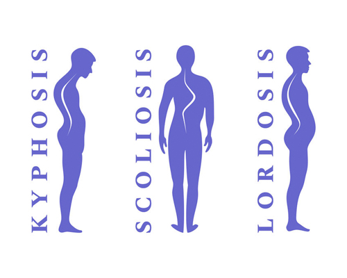 SPINAL DEFORMITIES